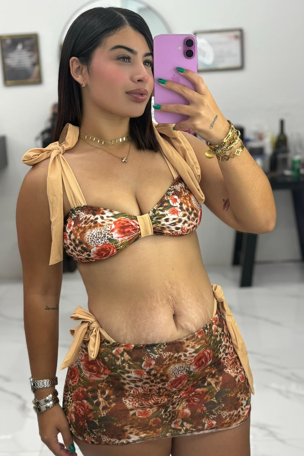 FEMORA