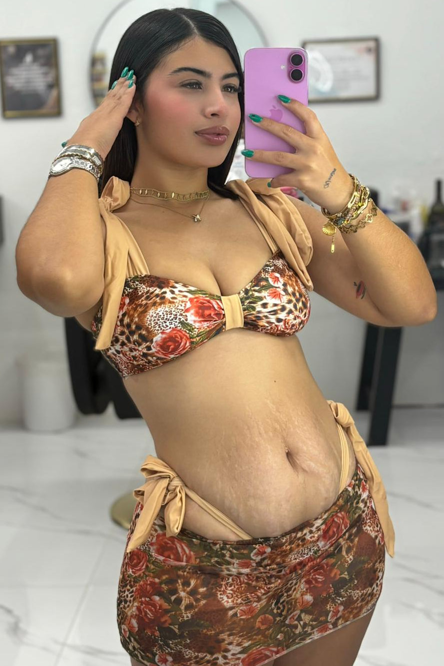 FEMORA